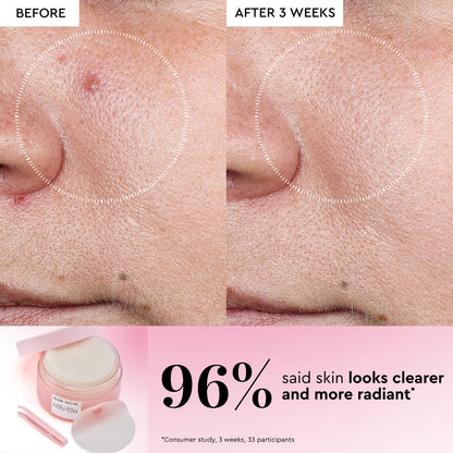 LHA + AHA Korean Watermelon Toner Pads