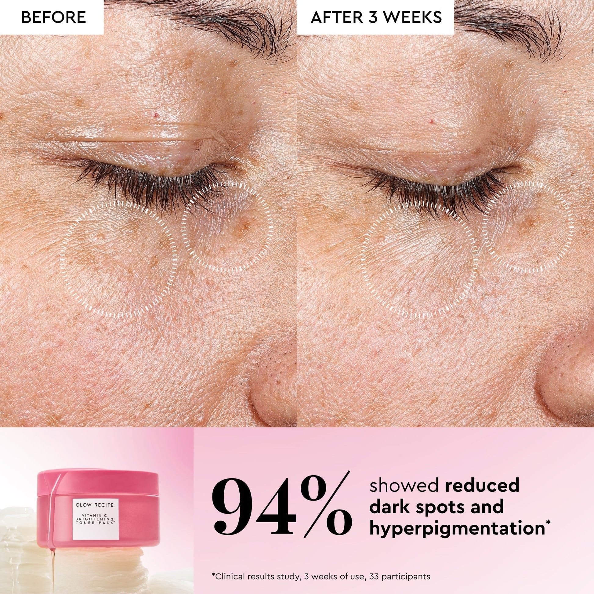 Korean Toner Pad Multi-Masking Kit